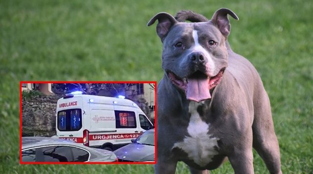 TMERR në park: Qeni kafshon në fytyrë një fëmijë 3-vjeçar, dërgohet me urgjencë në spital