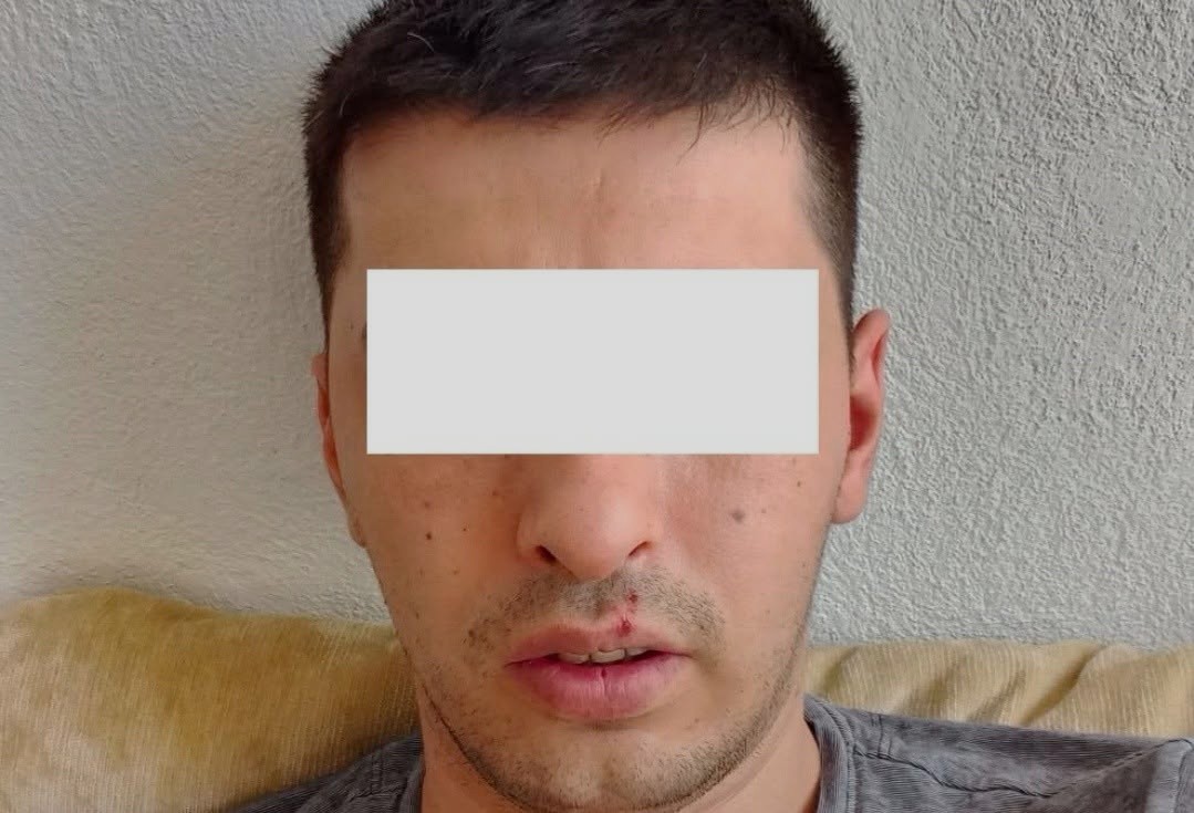Detaje tronditëse nga vr.asja në Shkup: Ky është djali që dyshohet se vra.u babanë e tij, për veten thoshte se ishte profet